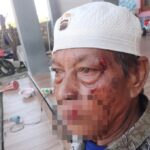 Pria di Camplong Ngamuk! Hantam Kerabat Pakai Kursi hingga Kayu Jati, Korban Luka Parah