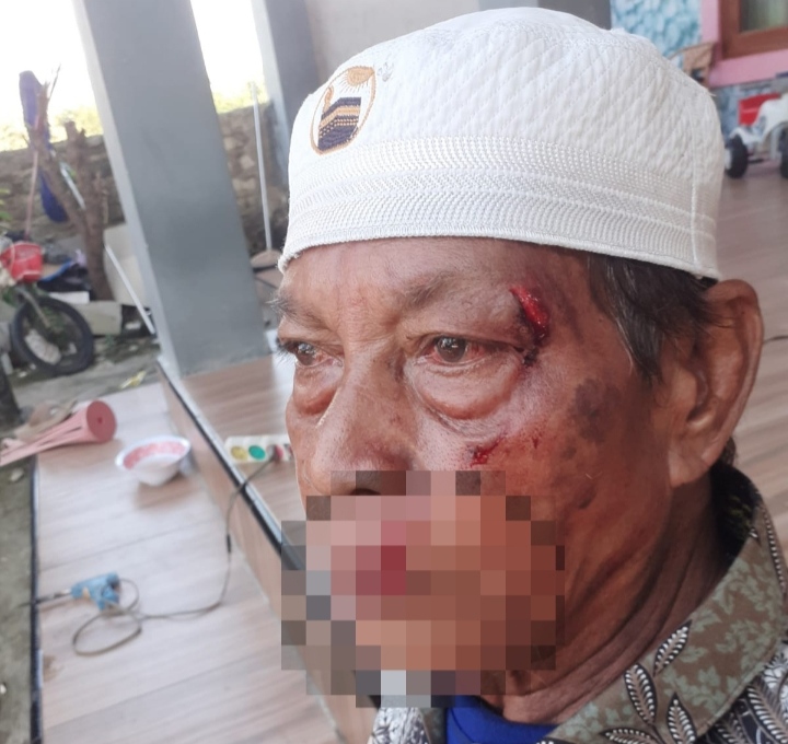 Pria di Camplong Ngamuk! Hantam Kerabat Pakai Kursi hingga Kayu Jati, Korban Luka Parah